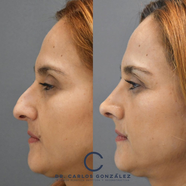 Slider image (2) Dr. Carlos Gonzalez Alvarado